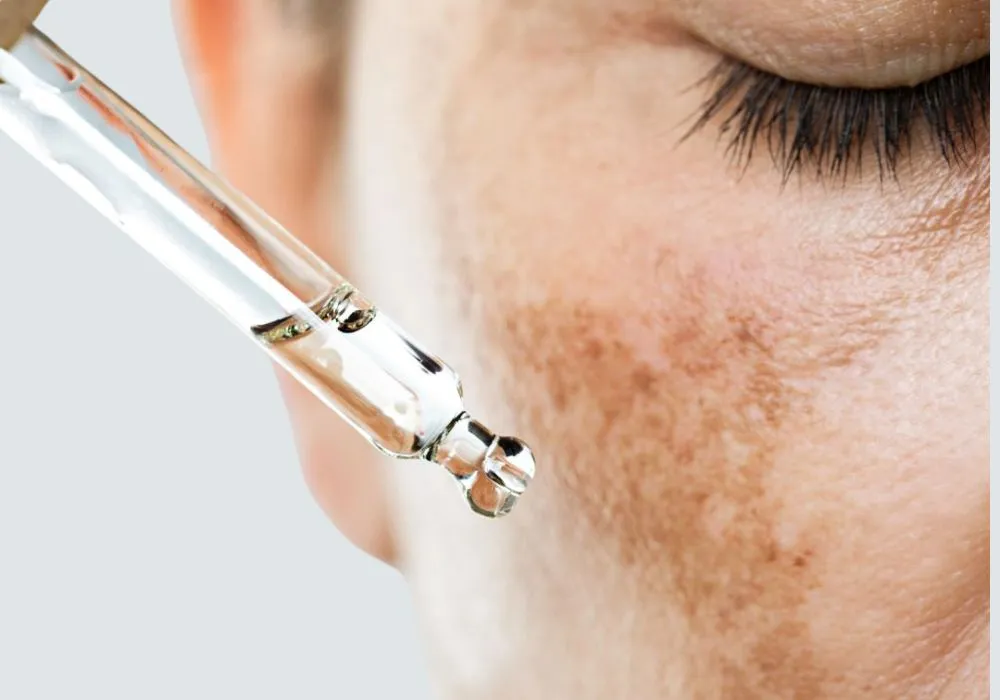 The Role of Hormones in Skin Pigmentation: From Pregnancy to Birth Control